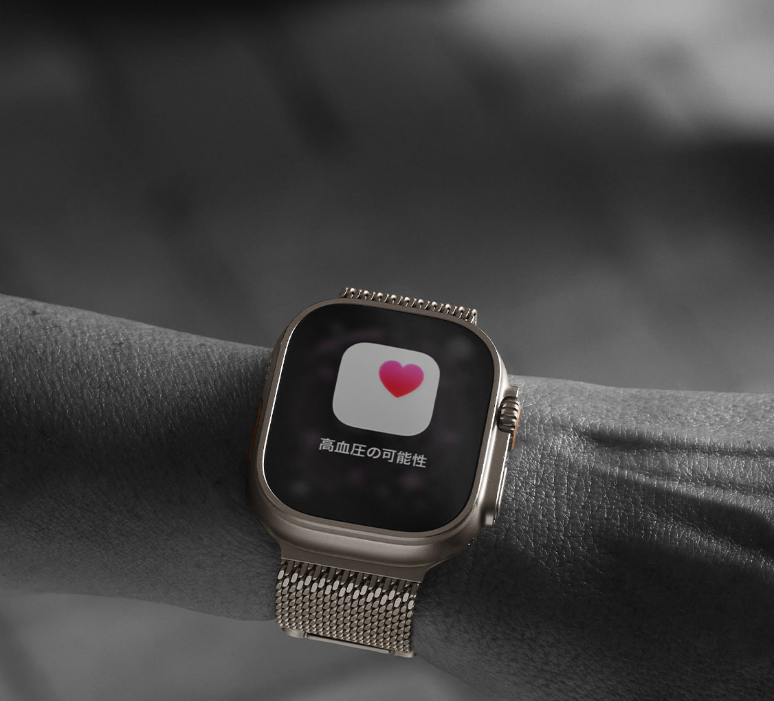 Apple Watch Ultra 3｜au