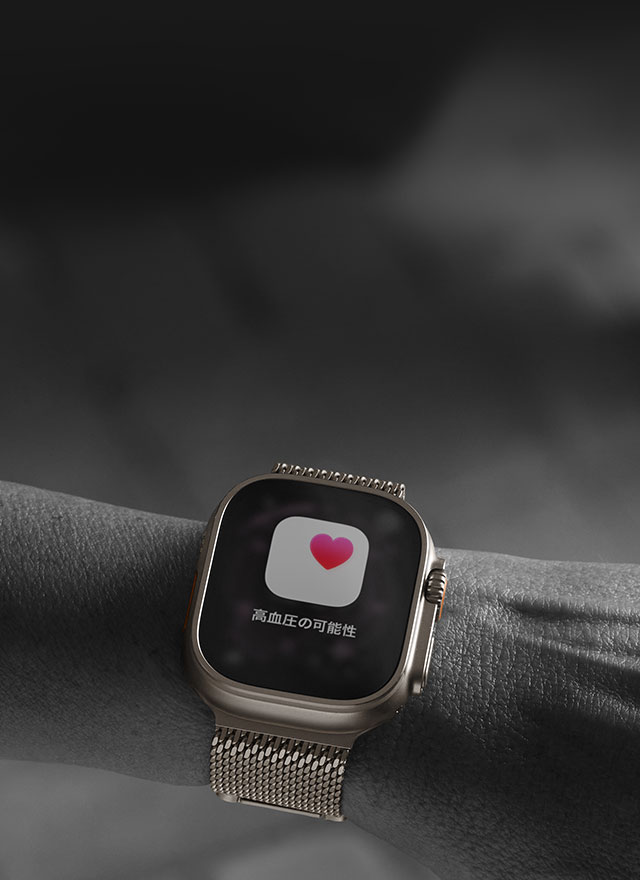 Apple Watch Ultra 3｜au